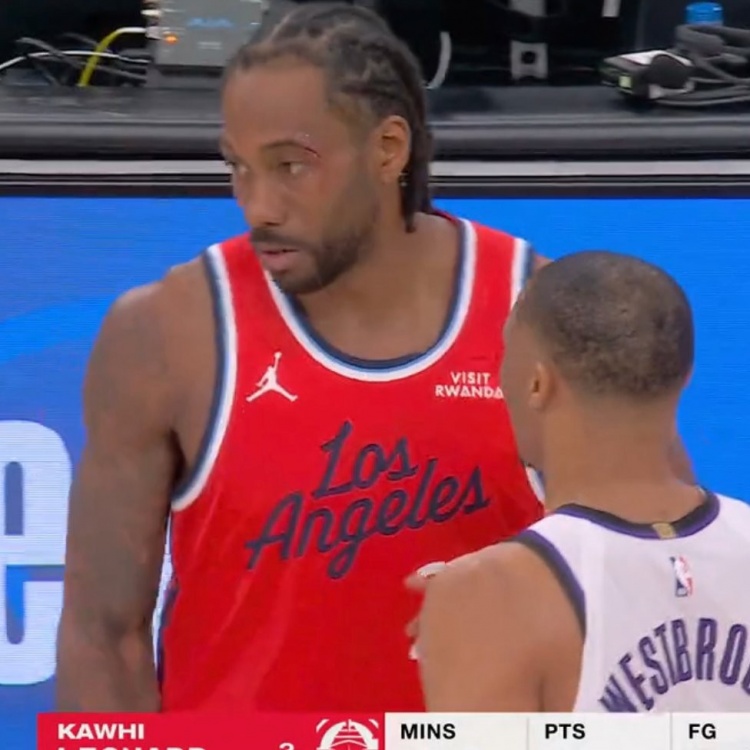 九游体育-小卡眼角被打破血流不止 回更衣室治疗之后已经重回球场